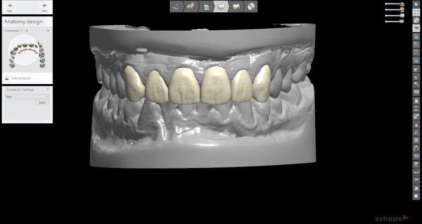 Digital Protocols for Dentistry