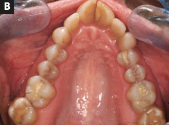 airway issues