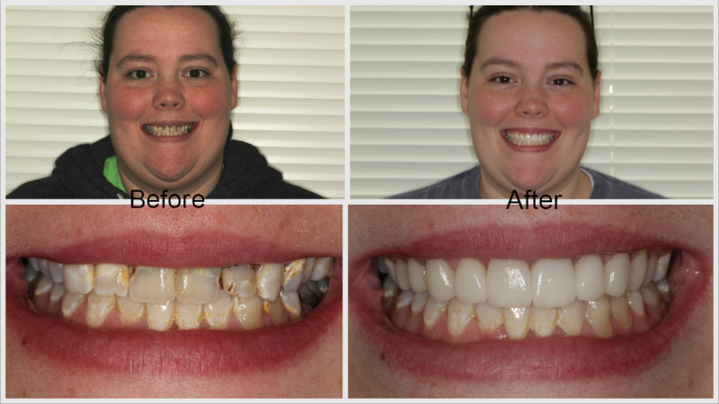 Phased Treatment Plan: Before and After