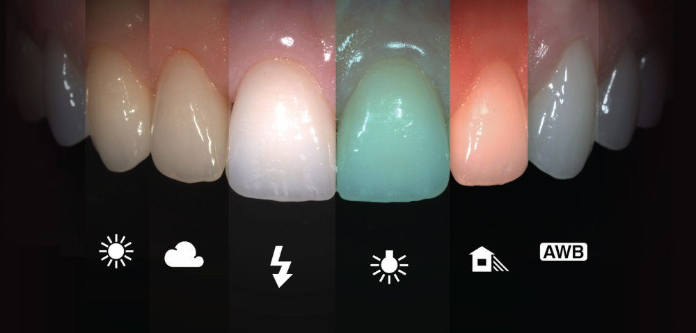 dental photography lighting